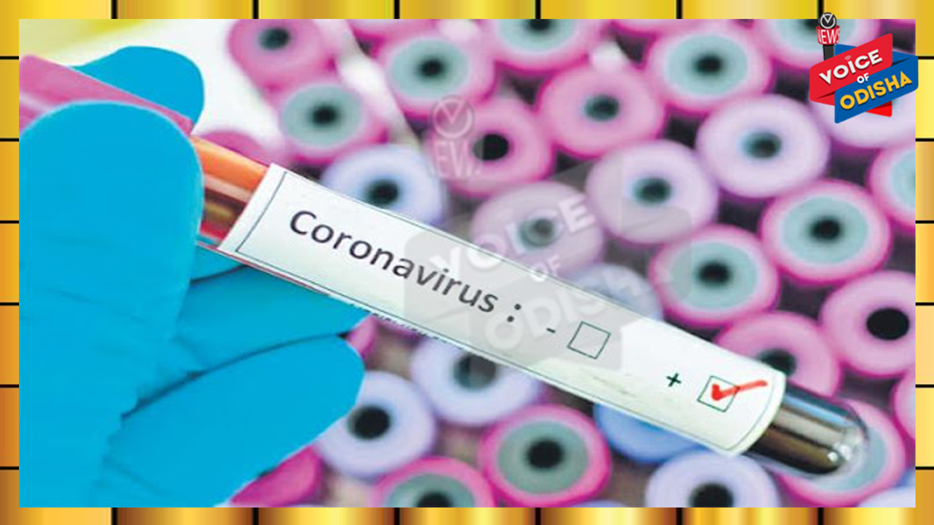 ୨୪ ଘଣ୍ଟା ମଧ୍ୟରେ ରାଜ୍ୟରେ ୮୨ କରୋନା ପଜିଟିଭ୍ ଚିହ୍ନଟ