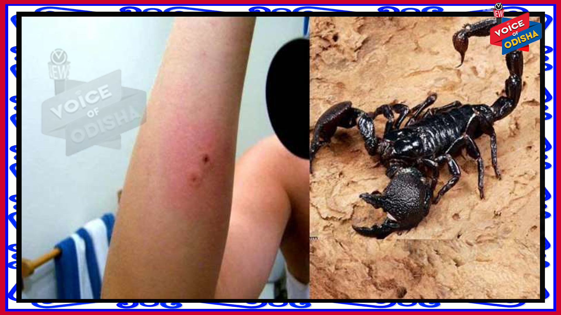 ଜାଣିରଖନ୍ତୁ ବିଛା କାମୁଡିଲେ କ’ଣ କରିବେ, ଏହି ଛୋଟିଆ ପ୍ରୟାସ କାହାର ଜୀବନ ବଞ୍ଚାଇଦେଇପାରେ