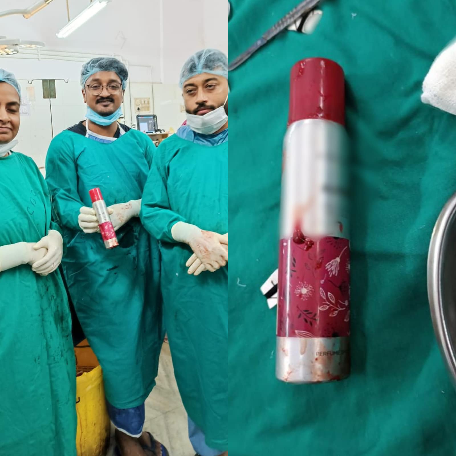 ଯୁବକଙ୍କ  ପେଟରୁ ବାହାରିଲା ଡିଓଡରାଣ୍ଟ ବୋତଲ