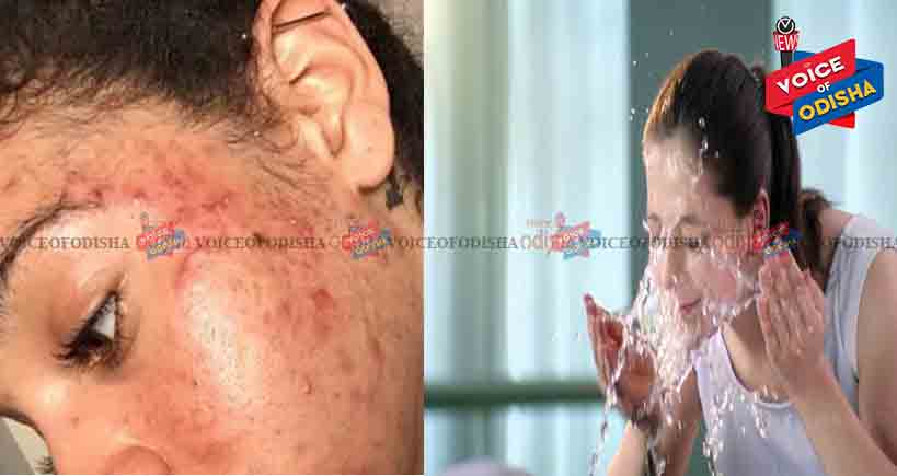 ବାରମ୍ବାର ମୁହଁ ଧୋଉଥିଲେ ସାବଧାନ !