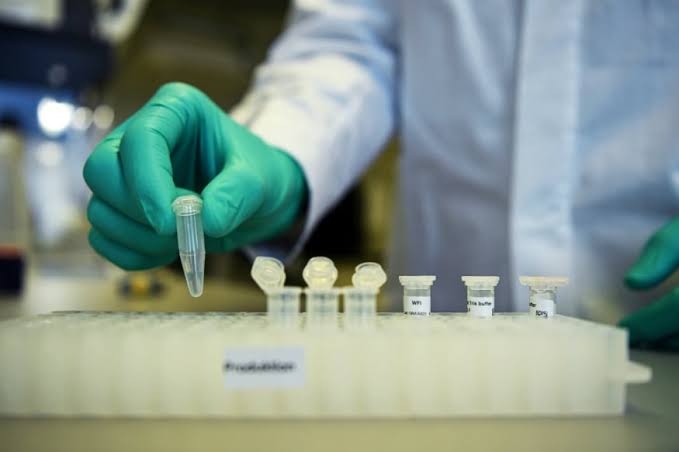 ଅକ୍ସଫୋର୍ଡ ବୈଜ୍ଞାନିକ ତିଆରି କଲେ କରୋନା ଆଣ୍ଟିବଡ଼ି କିଟ୍‌, ୨୦ ମିନିଟରେ ମିଳିବ ରିପୋର୍ଟ