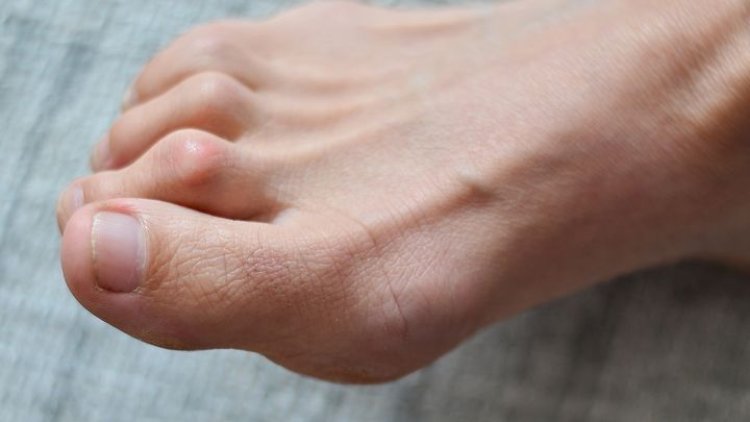 ପାଦ ଆଙ୍ଗୁଠି କହିବ ଆପଣଙ୍କ ଭାଗ୍ୟ