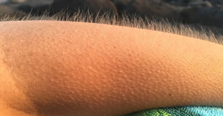 ଡର କିମ୍ବା ଥଣ୍ଡା ଲାଗିଲେ କାହିଁକି ଟାଙ୍କୁରି ଉଠେ ଲୋମ? ଜାଣନ୍ତୁ କାରଣ