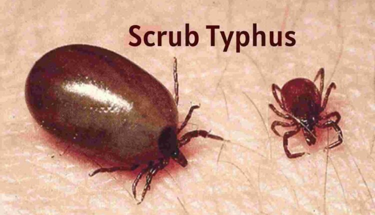 3 more Scrub Typhus cases in Odisha’s Sundargarh, total rises to 183