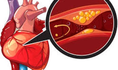 ହୃଦଘାତରେ ରୋଗୀମାନେ କ’ଣ ଖାଇବା ଆବଶ୍ୟକ